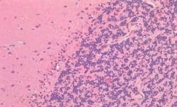 ROR1 Antibody, Novus Biologicals 50 &mu;g | Buy Online | Novus Biologicals | Fisher Scientific